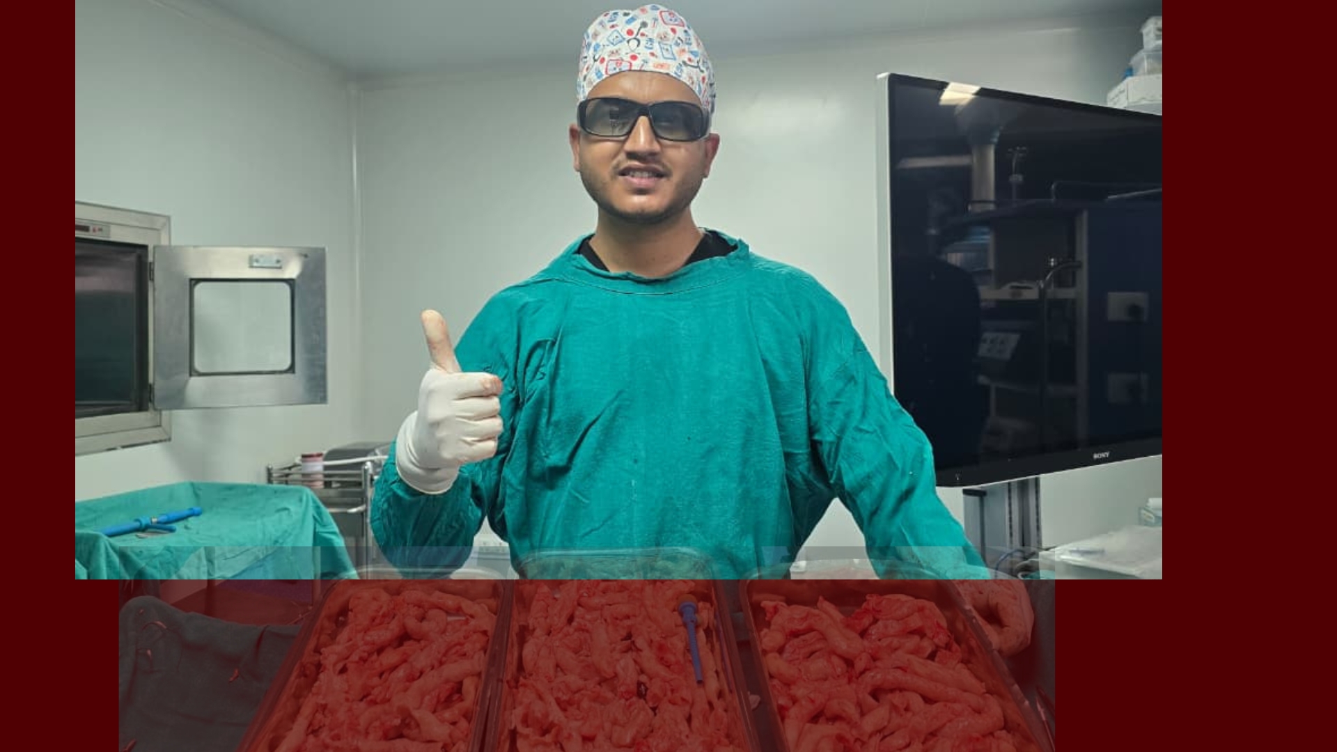एभरेष्ट अस्पतालमा अत्याधुनिक ल्याप्रोस्कोपिक प्रविधिबाट उपचार : १८ सेण्टिमिटरको विशाल फाइब्रॉइड सफल शल्यक्रिया